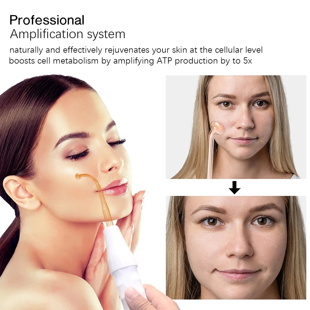 Portable High Frequency Skin Therapy Wand – Professional Facial & Hair Care Device