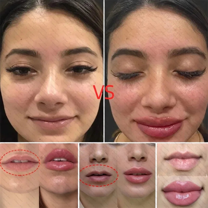 Extreme Volume Lip Plumper Serum – Advanced Hydration & Smoothing Care