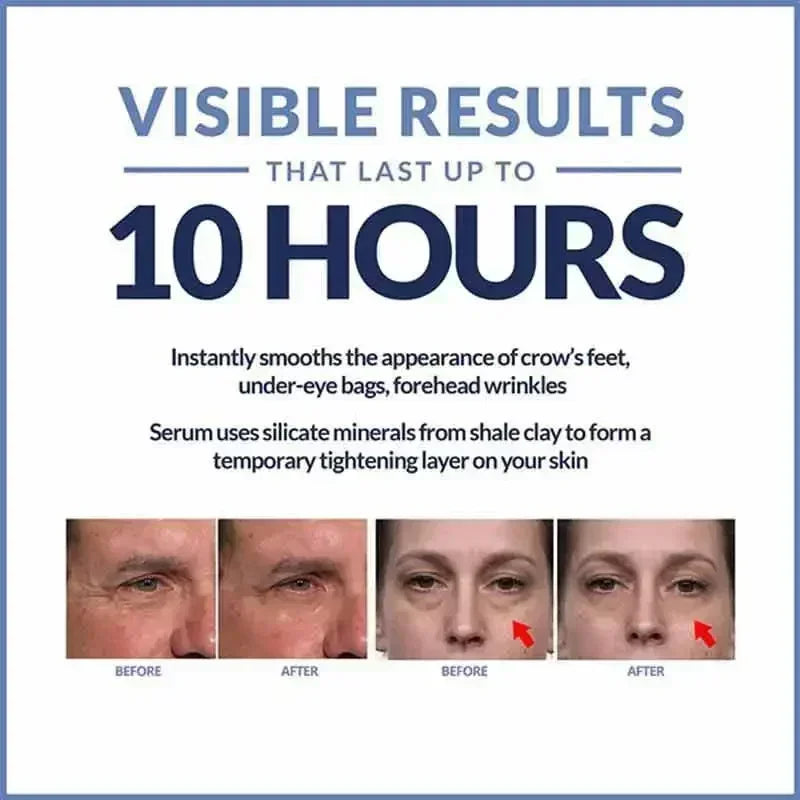 Instant Eye Cream – Anti-Ageing, Dark Circles & Puffiness Treatment