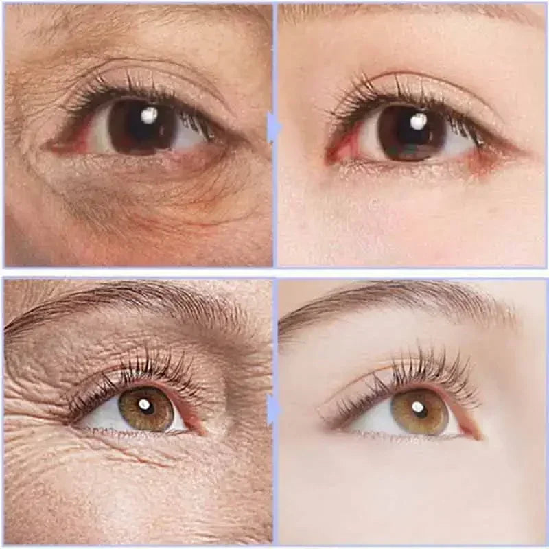 Instant Eye Cream – Anti-Ageing, Dark Circles & Puffiness Treatment
