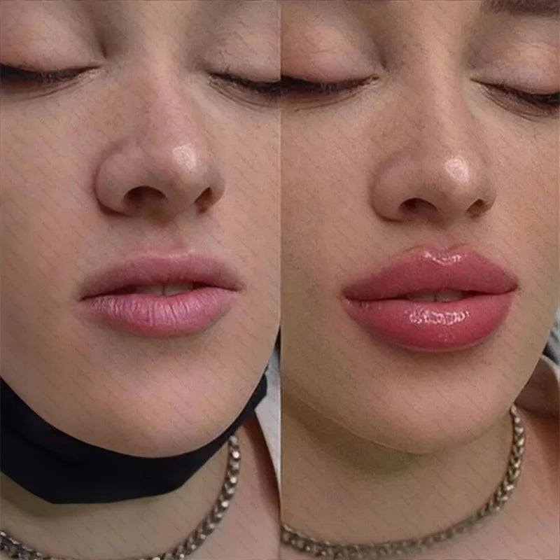 Extreme Volume Lip Plumper Serum – Advanced Hydration & Smoothing Care