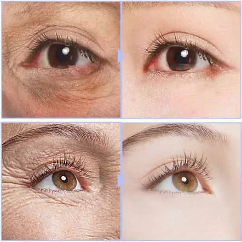 Instant Eye Cream – Anti-Ageing, Dark Circles & Puffiness Treatment