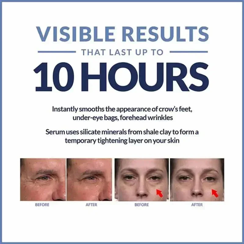 Instant Eye Cream – Anti-Ageing, Dark Circles & Puffiness Treatment