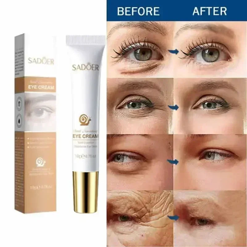 Instant Eye Cream – Anti-Ageing, Dark Circles & Puffiness Treatment