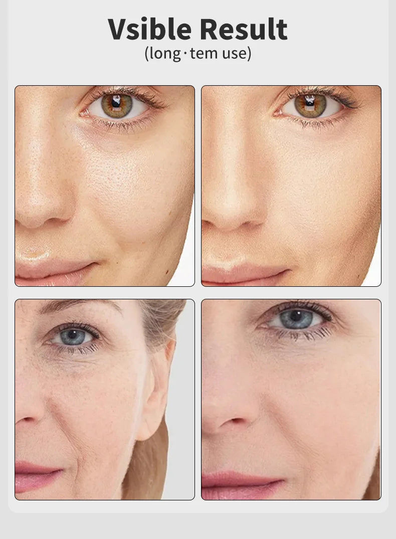 ✨ AGE-R BOOSTER PRO™ – Your At-Home Skin Rejuvenation Device